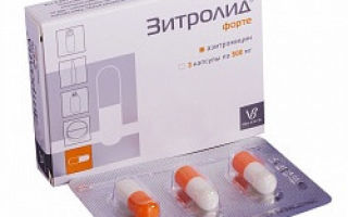Зитролид