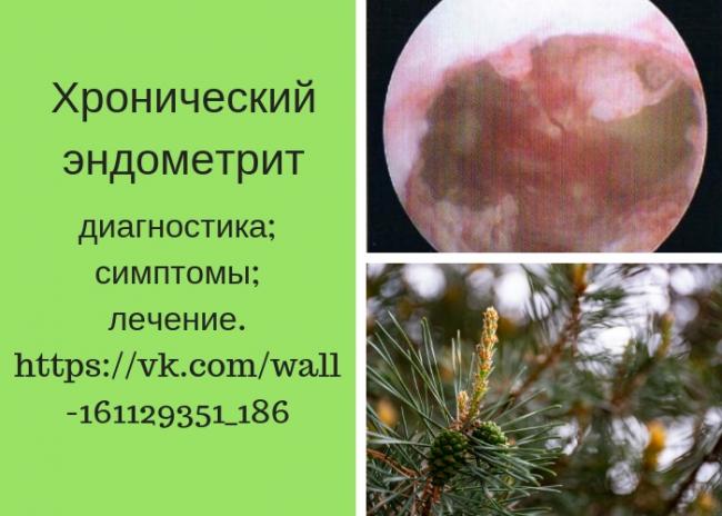 Эндометрит: признаки и лечение воспаления слизистой матки