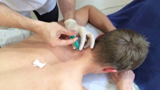 Блокада при грыже поясничного отдела позвоночника