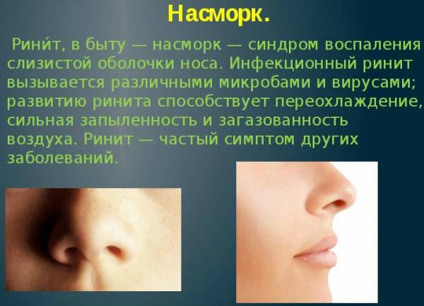 Хорошие лекарства от простуды без температуры