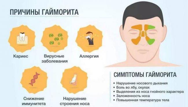 Психосоматика: гайморит