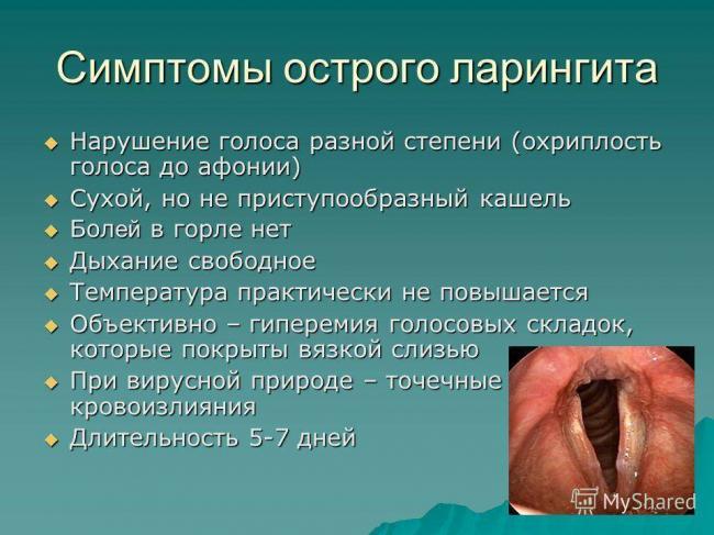 Ларинготрахеит: причины, симптомы, диагностика и лечение