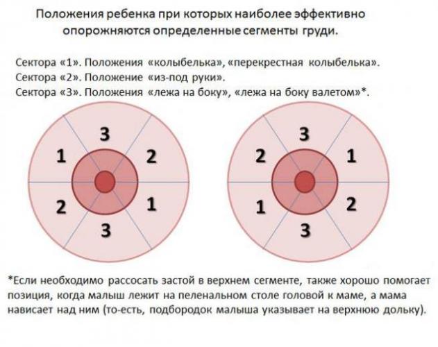 Симптомы и порядок лечения лактостаза у кормящей матери
