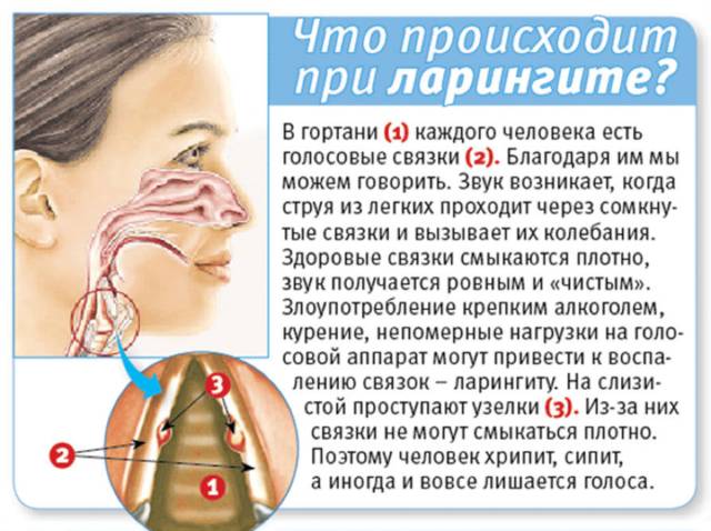 Трахеит: признаки, симптомы, лечение. как лечить трахеит детям и взрослым