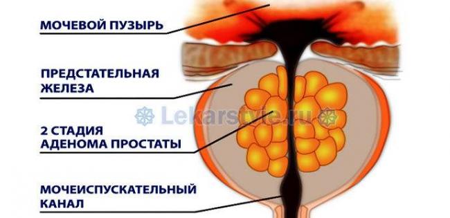 Простамол уно : инструкция по применению