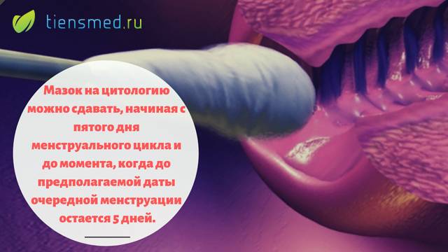 Неактивный хронический цервицит шейки матки