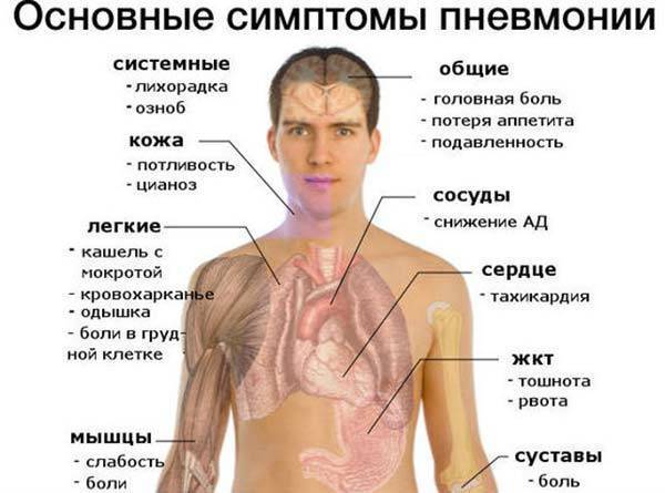 Температура при пневмонии