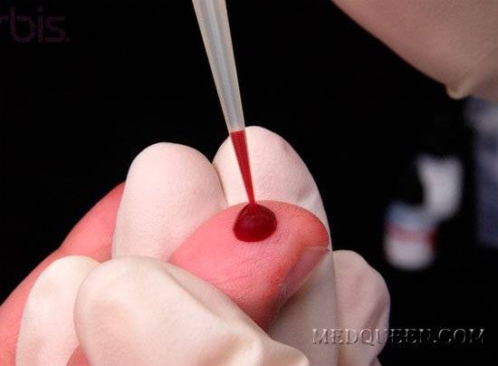 Почему возникает микроцитарная анемия и как ее лечить