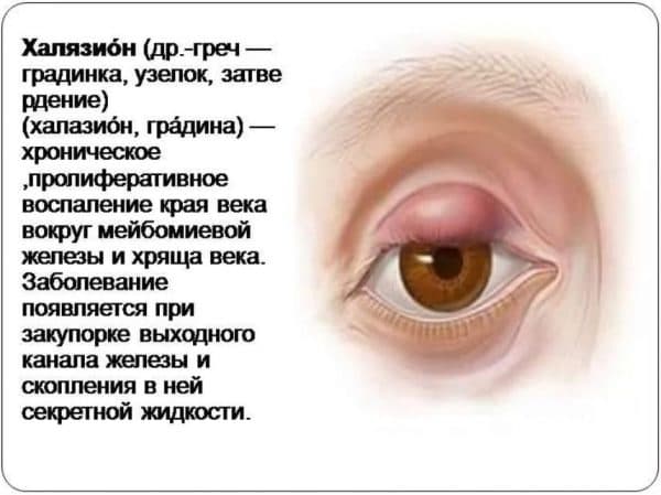Воспаление века глаза народные средства