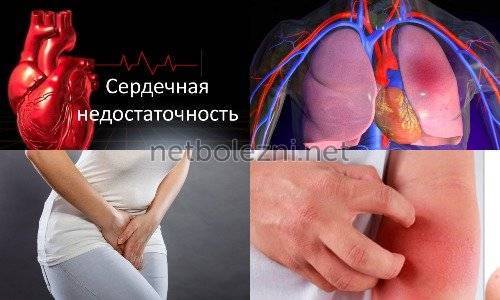 Актовегин отзывы
