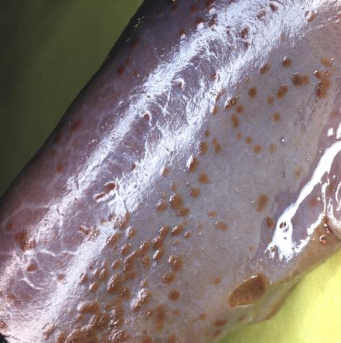 Асфиксия