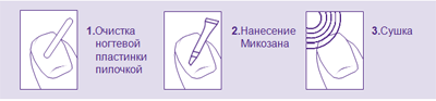 Микозон от грибка ногтей