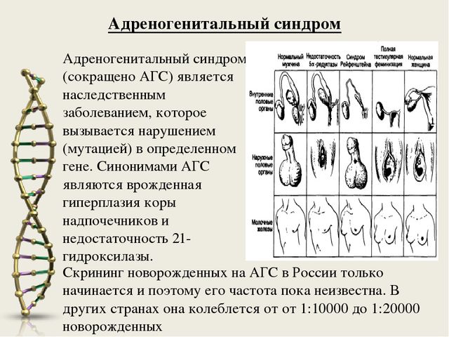 Адреногенитальный синдром: что это такое. причины, симптомы и лечение адреногенитального синдрома |
эко-блог