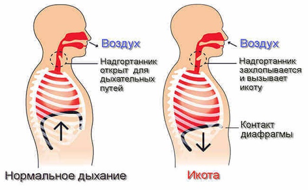 Икота у взрослого. как быстро избавиться в домашних условиях. таблетки, народные методы