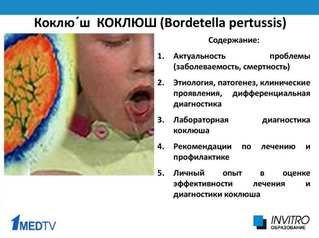 Коклюш у детей и взрослых: симптомы, лечение медикаментами и народными методами