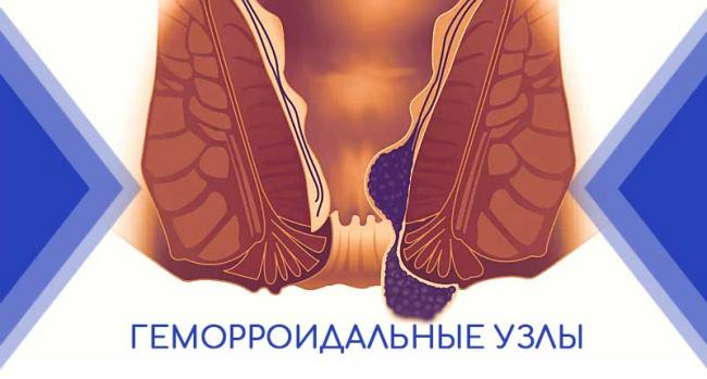 Что нужно знать о мази постеризан