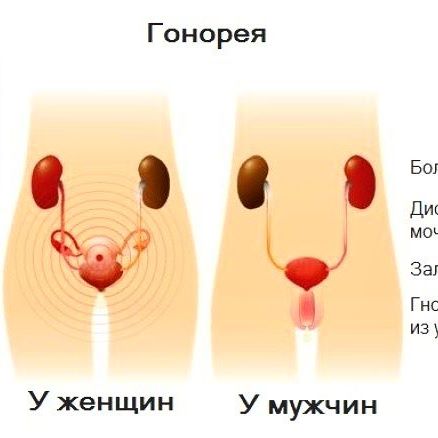 Гонорея болезнь чем ее лечить