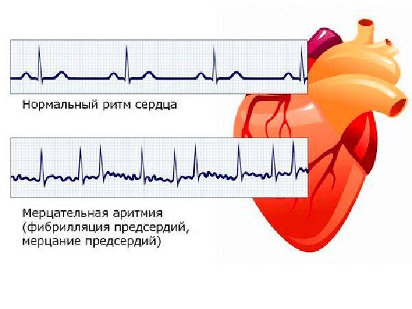 Таблетки таваник 500 от чего помогает. Таваник антибиотик инструкция по применению