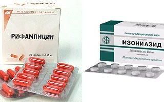 Милиарный туберкулез: симптомы, диагностика
