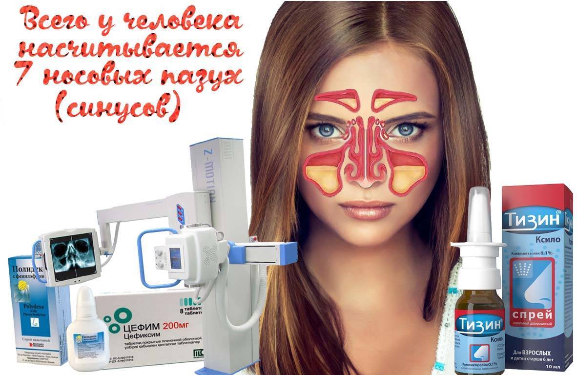 Быстрое лечение гайморита у взрослых в домашних условиях: аптечные препараты, народные средства