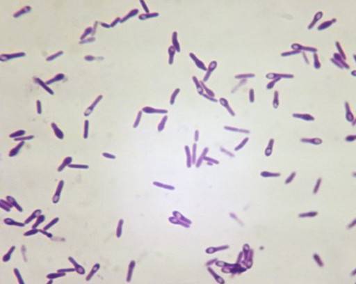 Царство архебактерии - archaebacteria