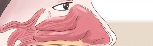 Если заложен нос и капли не помогают: что делать?