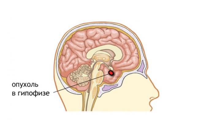 Аденогипофиз википедия
