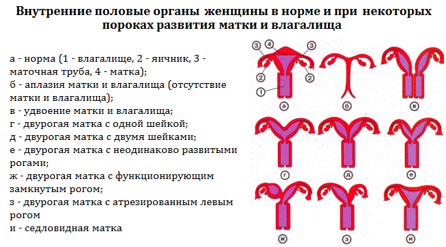 Недоразвитие органа это