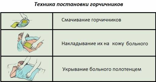 Можно ли ставить банки детям и взрослым при лечении бронхита: рекомендации