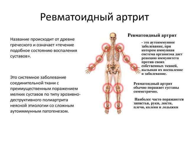 Иммард