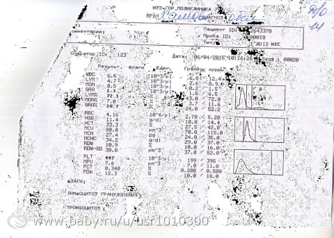 Лимфоцитоз у взрослых. причины, симптомы, лечение, анализ крови