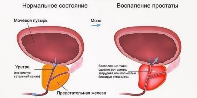 Таблетки таваник 500 от чего помогает. Таваник антибиотик инструкция по применению