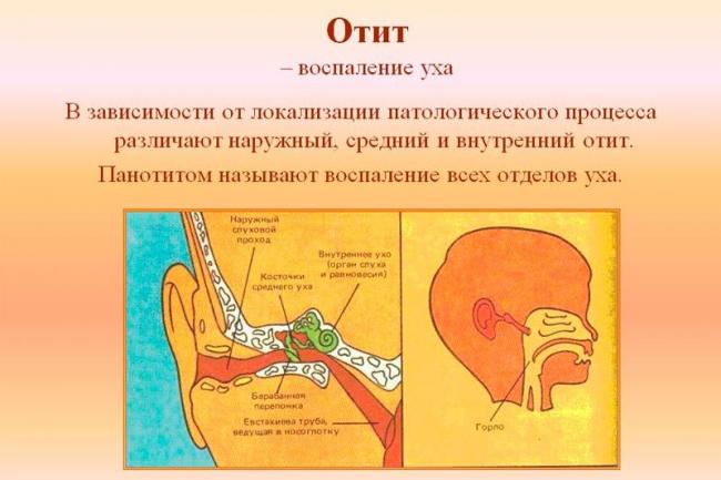 Наружный отит. причины, симптомы и лечение болезни