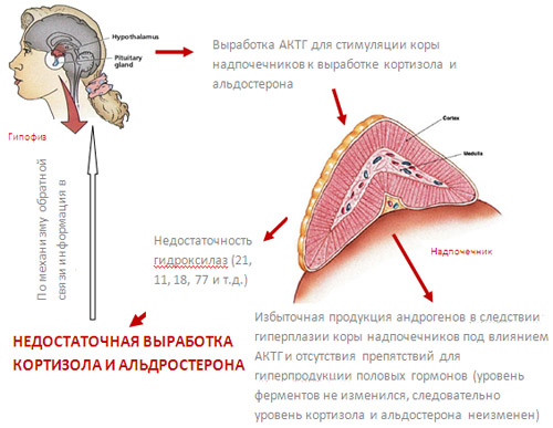 Адреногенитальный синдром