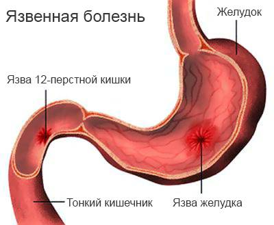 Болезнетворными бактериями являются