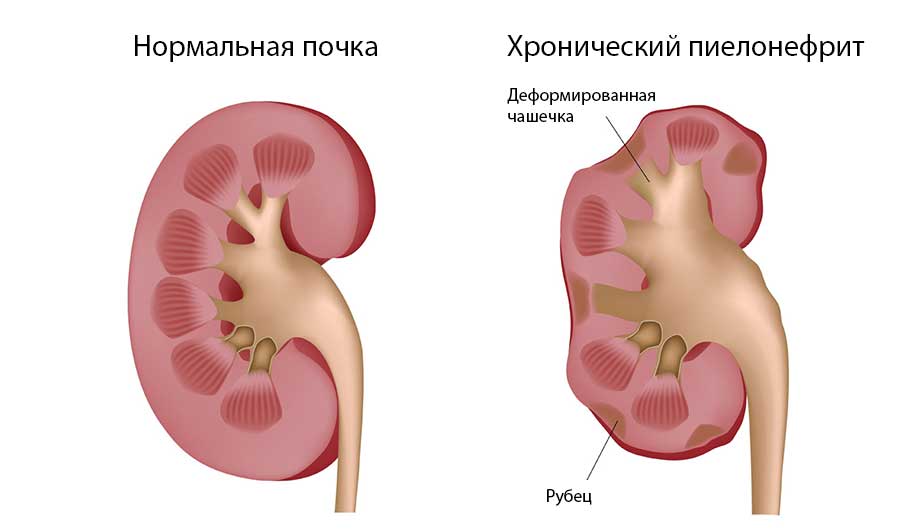 Антибиотик Канамицин чем его разводить, инструкция по применению и побочные действия, аналоги и отзывы