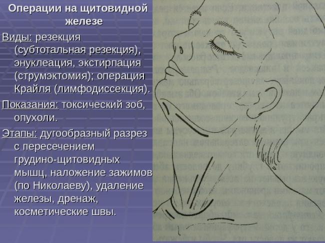 Где находится щитовидная железа, и как можно проверить щитовидку в домашних условиях?