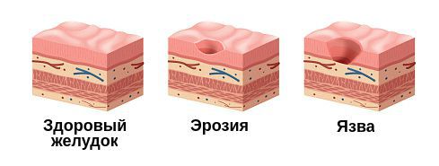 Вот же язва!