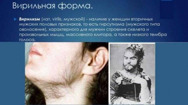 Адреногенитальный синдром - описание, патогенез, симптомы, диагностика, лечение.