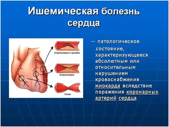 Лечебное питание при ишемической болезни сердца