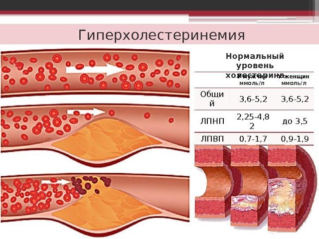 Аллеста