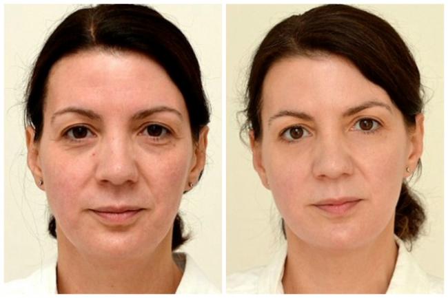 8 стаканов воды: 8 простых трюков, которые помогут не забывать про них каждый день