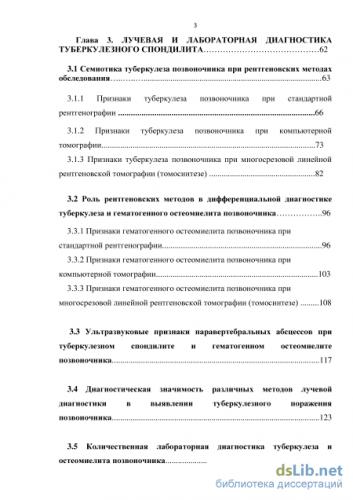 Спондилит позвоночника