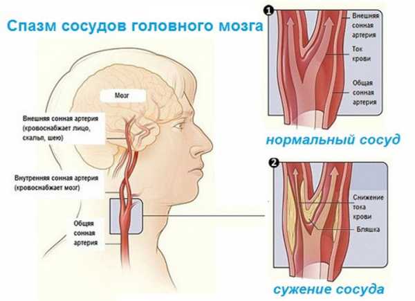 Адельфан-эзидрекс – инструкция по применению, показания, дозы, аналоги