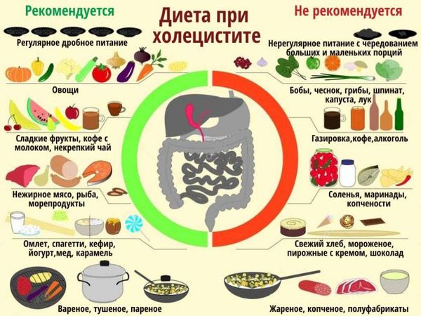 Камни в поджелудочной железе симптомы лечение диета