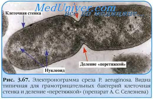Синегнойная инфекция