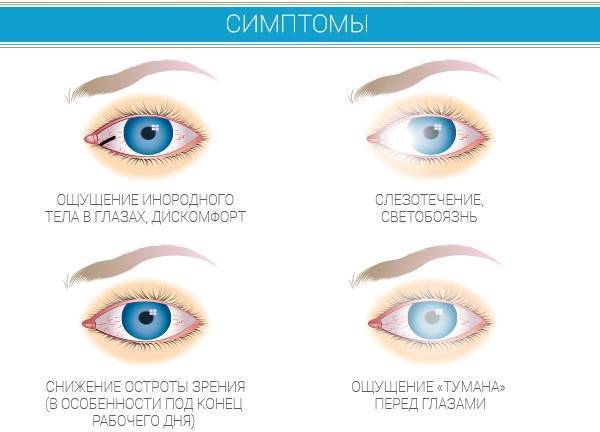 Скотома (темные пятна в поле зрения): что это такое?