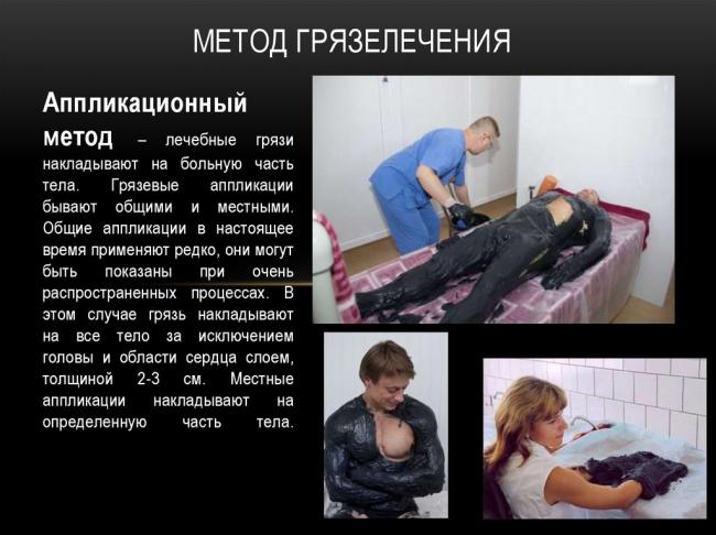 Пелоидотерапия википедия