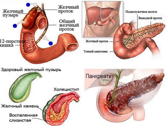 Питание при камней поджелудочной железы