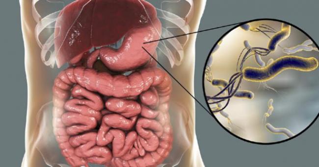 Какой анализ на хеликобактер самый точный? отвечает врач | gastro-blog.ru